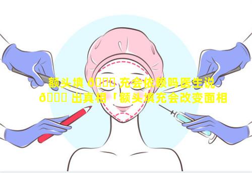 额头填 🕊 充会依赖吗医生说 🕊 出真相「额头填充会改变面相吗」